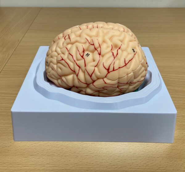 Encéphale - 3D – Image 5