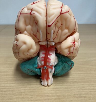 Encéphale - 3D